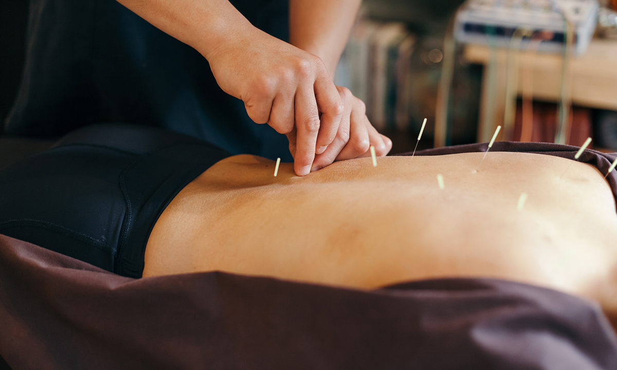 Midtown Toronto acupuncture services 