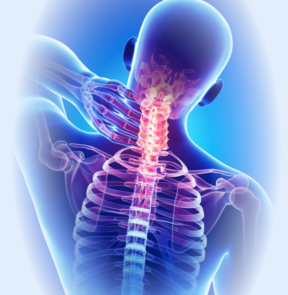 Physiotherapy in Toronto for Cervical Radiculopathy