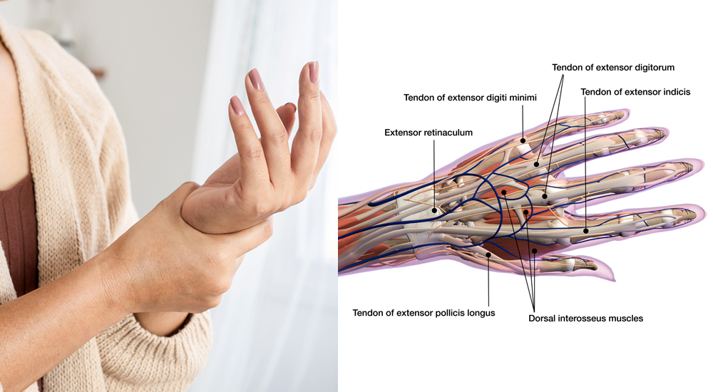 Physiotherapy for best sale hand pain