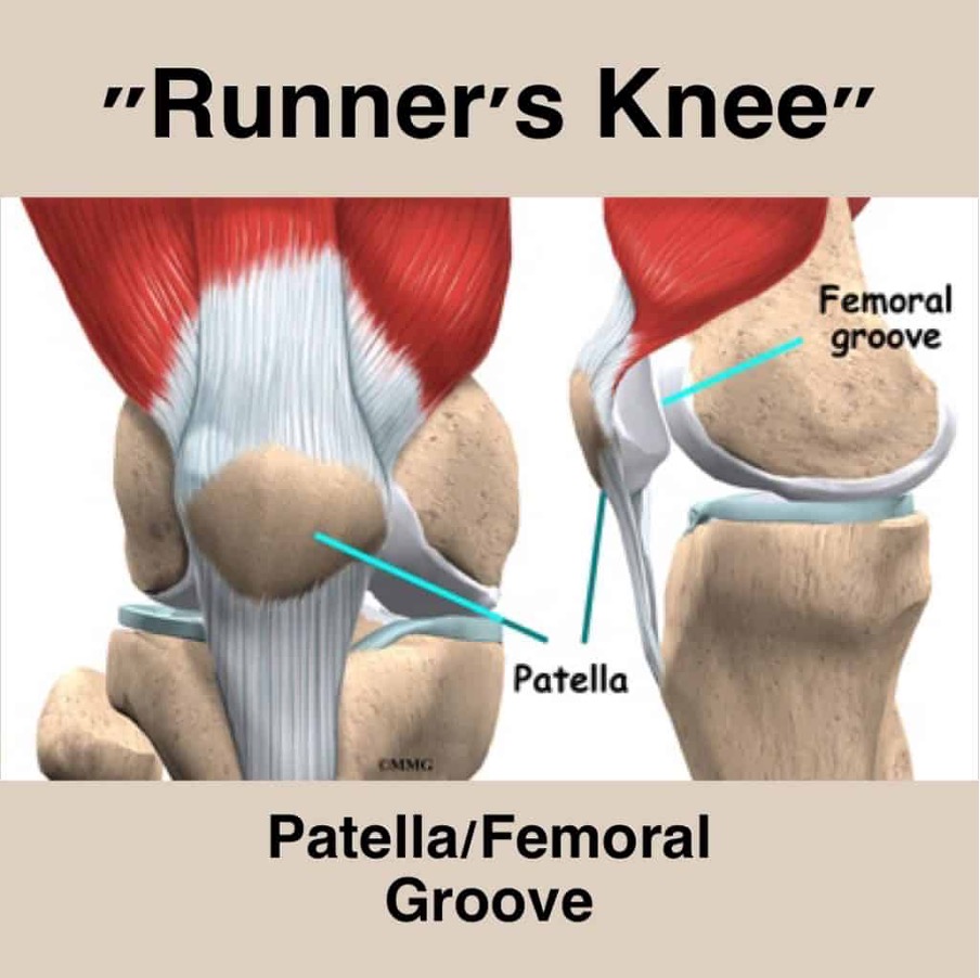 Runner's knee physiotherapy services in Toronto